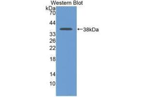 Western blot analysis of recombinant Rat LDHB.