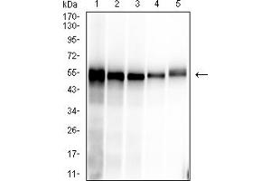 Western blot analysis using SARS-CoV-2-NP1 mAb against human SARS-CoV-2-N (AA: 1-419) recombinant protein. (SARS-Cov2-NP1 (AA 1-180) Antikörper)