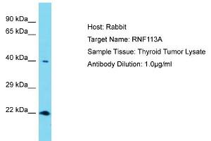 Host: Rabbit Target Name: RNF113A Sample Tissue: Human Thyroid Tumor Antibody Dilution: 1ug/ml