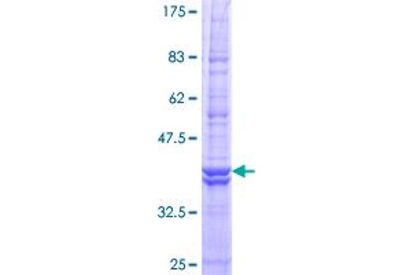 ATP6V0C Protein (AA 1-155) (GST tag)