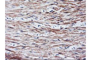 Immunohistochemical staining of paraffin-embedded Human colon tissue using anti-TAL1 mouse monoclonal antibody. (TAL1 Antikörper)