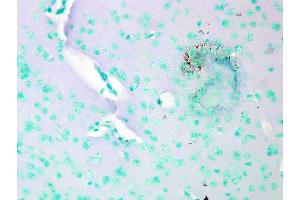 Immunohistochemistry (IHC) image for anti-Calcium Channel, Voltage-Dependent, L Type, alpha 1C Subunit (CACNA1C) (AA 1507-1733) antibody (PE) (ABIN2485661)