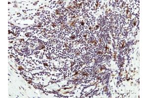 Immunohistochemical staining of paraffin-embedded Human lymph tissue using HICE1 antibody at a dilution of 1:50 (NYS48/HAUS8 Antikörper)