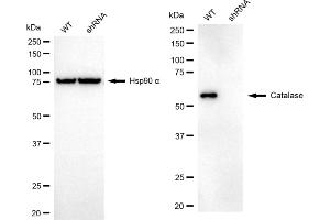 Western blotting analysis using Catalase antibody (ABIN7797918).