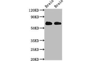Western Blot Positive WB detected in: Rat brain tissue, Mouse brain tissue All lanes: SLC1A2 antibody at 3. (SLC1A2 Antikörper  (AA 460-574))