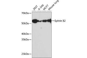 Western blot analysis of extracts of various cell lines, using Ephrin B2 Rabbit mAb (ABIN7266978) at 1:1000 dilution. (Ephrin B2 Antikörper)