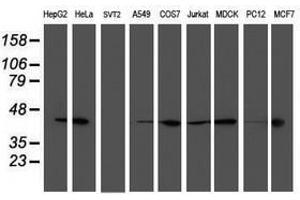 Image no. 2 for anti-Spermine Synthase, SMS (SMS) antibody (ABIN1501095) (SMS Antikörper)