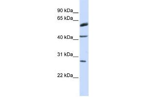 Western Blotting (WB) image for anti-Ring Finger Protein 170 (RNF170) antibody (ABIN2458738) (RNF170 Antikörper)