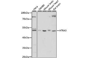 Western blot analysis of extracts of various cell lines, using HTRA3 antibody. (HTRA3 Antikörper)