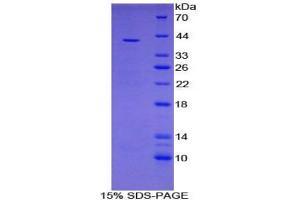 SDS-PAGE (SDS) image for V-Set Domain Containing T Cell Activation Inhibitor 1 (VTCN1) ELISA Kit (ABIN6574330)
