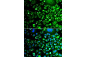 Immunofluorescence analysis of A549 cells using MOCS3 antibody. (MOCS3 Antikörper  (AA 271-460))