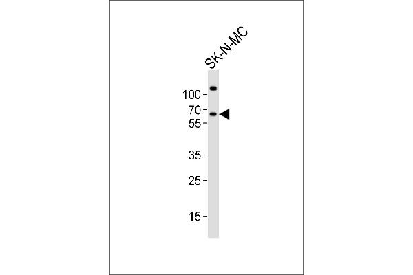 PPP2R5B Antikörper  (C-Term)