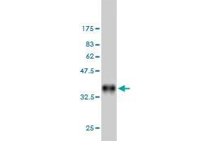 Western Blot detection against Immunogen (35. (DAPK2 Antikörper  (AA 281-370))