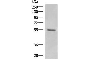 Western blot analysis of Human skin tissue lysate using KRT36 Polyclonal Antibody at dilution of 1:1000 (Keratin 36 Antikörper)