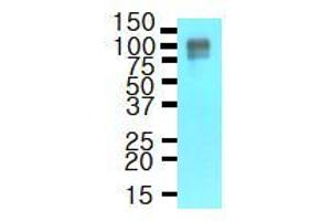 Western Blotting (WB) image for anti-Amyloid beta (A4) Precursor Protein (APP) (AA 18-289) antibody (ABIN317496) (APP Antikörper  (AA 18-289))