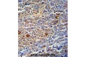 Immunohistochemistry (IHC) image for anti-Chromosome 9 Open Reading Frame 156 (C9orf156) antibody (ABIN3002894) (C9orf156 Antikörper)