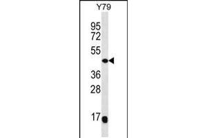 Western blot analysis in Y79 cell line lysates (35ug/lane). (MAP2K4 Antikörper  (C-Term))