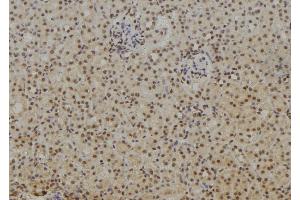 Immunohistochemistry (IHC) image for anti-Nuclear Factor of kappa Light Polypeptide Gene Enhancer in B-Cells 1 (NFKB1) (C-Term) antibody (ABIN6263615)
