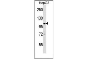 Western blot analysis of KIF18A Antibody (C-term) in HepG2 cell line lysates (35ug/lane). (KIF18A Antikörper  (C-Term))