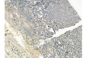 ABIN6260586 and ABIN6276860 at 1/100 staining human normal tonsil tissue by IHC-P. (CD1d Antikörper  (Internal Region))