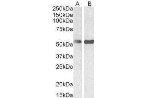 Image no. 3 for anti-Polypyrimidine Tract Binding Protein 1 (PTBP1) antibody (ABIN5874678) (PTBP1 Antikörper)