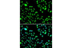 Immunofluorescence analysis of MCF-7 cells using L3MBTL3 antibody. (L3MBTL3 Antikörper)