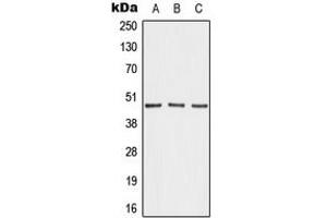 Western blot analysis of AKAP5 expression in MDAMB231 (A), NIH3T3 (B), H9C2 (C) whole cell lysates.