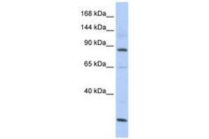 Image no. 1 for anti-MutS Homolog 5 (MSH5) (AA 107-156) antibody (ABIN6740728) (MSH5 Antikörper  (AA 107-156))