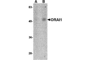 Western Blotting (WB) image for anti-ORAI Calcium Release-Activated Calcium Modulator 1 (ORAI1) (C-Term) antibody (ABIN492546)