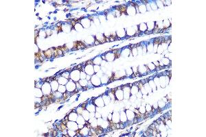 Immunohistochemistry of paraffin-embedded human colon using LOX Rabbit mAb (ABIN7268347) at dilution of 1:100 (40x lens). (LOX Antikörper)