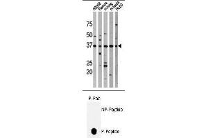 Image no. 1 for anti-Tumor Protein P53 (TP53) (pThr18) antibody (ABIN358195) (p53 Antikörper  (pThr18))