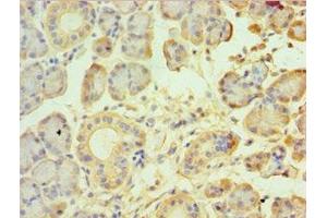Immunohistochemistry of paraffin-embedded human pancreatic tissue using ABIN7172857 at dilution of 1:100 (TRPM2 Antikörper  (AA 1204-1503))