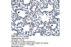 Immunohistochemistry (IHC) image for anti-Cbp/p300-Interacting Transactivator, with Glu/Asp-Rich Carboxy-terminal Domain, 1 (CITED1) (Middle Region) antibody (ABIN2777537)