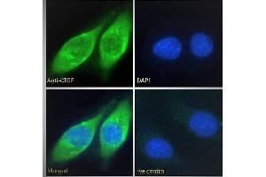 ABIN6391343 Immunofluorescence analysis of paraformaldehyde fixed HepG2 cells, permeabilized with 0.