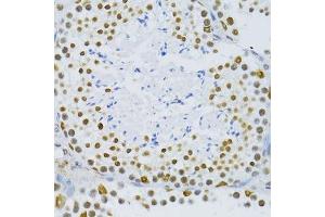 Immunohistochemistry of paraffin-embedded mouse testis using SNRNP70 antibody. (SNRNP70 Antikörper  (AA 150-250))
