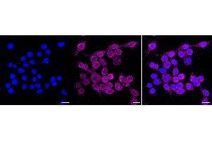 anti-Kinase Suppressor of Ras 1 (KSR1) antibody