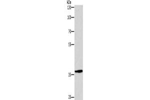 Gel: 8 % SDS-PAGE, Lysate: 40 μg, Lane: Hela cells, Primary antibody: ABIN7190518(DUSP2 Antibody) at dilution 1/300, Secondary antibody: Goat anti rabbit IgG at 1/8000 dilution, Exposure time: 1 minute (DUSP2 Antikörper)
