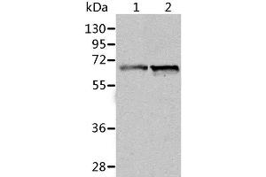 Western Blot analysis of Human fetal liver and liver cancer tissue using ALDH4A1 Polyclonal Antibody at dilution of 1:450 (ALDH4A1 Antikörper)