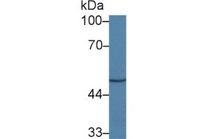 Detection of CADM1 in Porcine Cerebrum lysate using Polyclonal Antibody to Cell Adhesion Molecule 1 (CADM1) (CADM1 Antikörper  (AA 27-292))