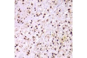 Immunohistochemistry (Paraffin-embedded Sections) (IHC (p)) image for anti-X-Ray Repair Complementing Defective Repair in Chinese Hamster Cells 6 (XRCC6) (AA 500-600) antibody (ABIN1513143)