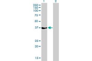 Western Blot analysis of RAD51 expression in transfected 293T cell line by RAD51 monoclonal antibody (M01), clone 2E5-E5. (RAD51 Antikörper  (AA 1-242))