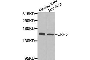 Western blot analysis of extracts of various tissues, using LRP5 antibody. (LRP5 Antikörper)