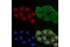 ABIN6259040 and ABIN6274387 staining Hela cells(45 min of heat-shock) by IF/ICC. (DAK Antikörper  (Internal Region))