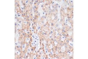 Immunohistochemistry of paraffin-embedded human liver using AREG antibody (ABIN6127431, ABIN6137065, ABIN6137066 and ABIN6216408) at dilution of 1:100 (40x lens). (Amphiregulin Antikörper  (AA 20-252))