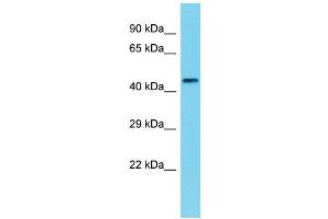 Host: Rabbit  Target Name: Phkg1  Sample Tissue: Rat Small Intestine lysates  Antibody Dilution: 1. (PHKG1 Antikörper  (N-Term))