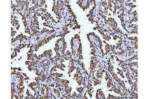 IHC analysis of COX5B using anti-COX5B antibody (ABIN7598975). (COX5B Antikörper  (AA 1-129))