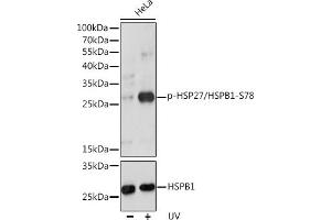 Western blot analysis of extracts of HeLa cells, using Phospho-HSP27/HSPB1-S78 pAb (ABIN3019892, ABIN3019893, ABIN3019894 and ABIN1681665) at 1:1000 dilution or HSP27/HSPB1 antibody (ABIN7267568). (HSP27 Antikörper  (pSer78))