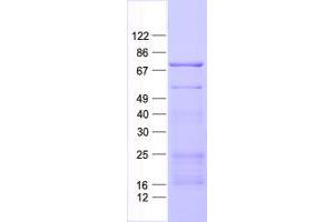 Validation with Western Blot