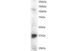 Image no. 1 for anti-PIN2/TERF1 Interacting, Telomerase Inhibitor 1 (PINX1) (N-Term) antibody (ABIN374171) (PINX1 Antikörper  (N-Term))