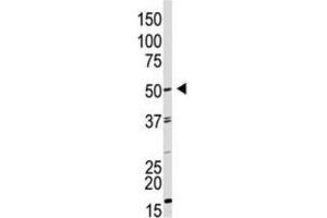 Western Blotting (WB) image for anti-Growth Differentiation Factor 9 (GDF9) antibody (ABIN3001444) (GDF9 Antikörper)